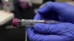WHO Officials Say Coronavirus Antibodies May Wane After Several Months 