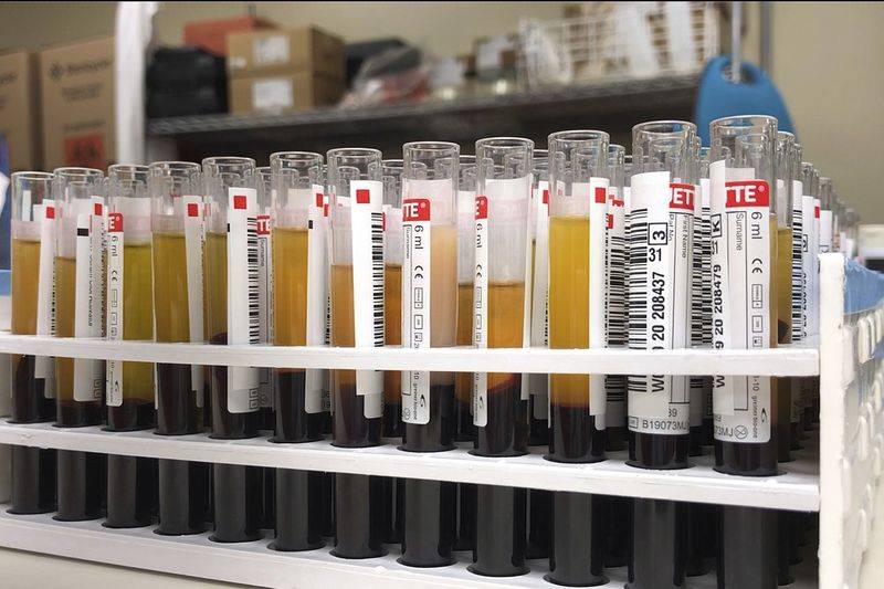 Blood type could be linked to severity of virus infections, new studies says